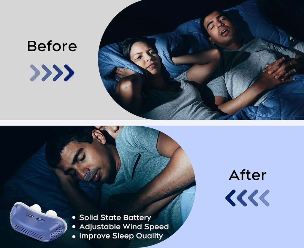 Compact Nasal Breathing Aid for Night Travel