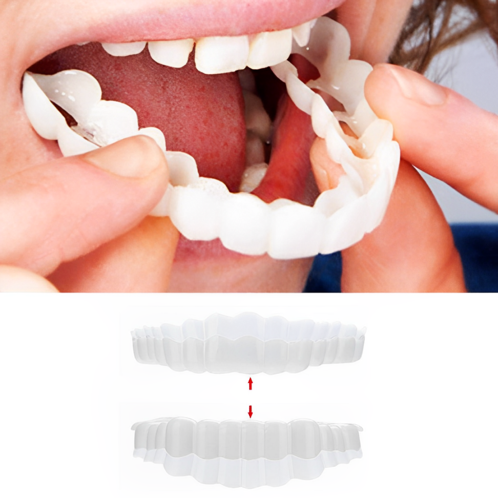Clip On Cosmetic Veneer Set Upper and Lower