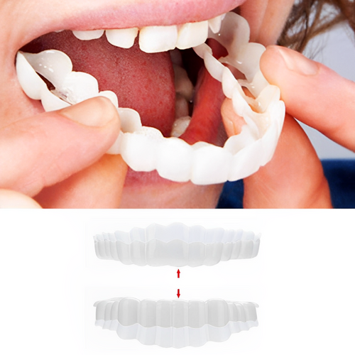 Clip On Cosmetic Veneer Set Upper and Lower