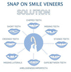 Clip On Cosmetic Veneer Set Upper and Lower