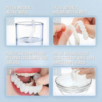 Clip On Cosmetic Veneer Set Upper and Lower